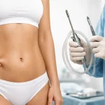 Abdominoplastia ou lipoaspiração: como decidir