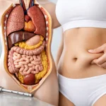 Lipoaspiração remove gordura visceral ou subcutânea?